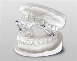Schnarchschiene (© Dr. Hinz KFO-Labor)